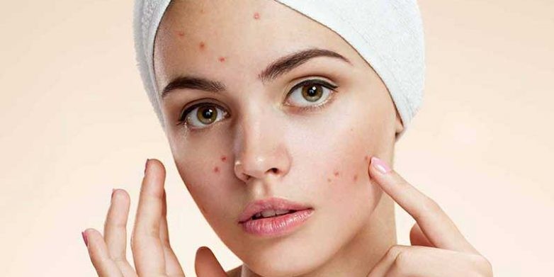 مطالبی که درباره داروهای ضد جوش باید بدانیم