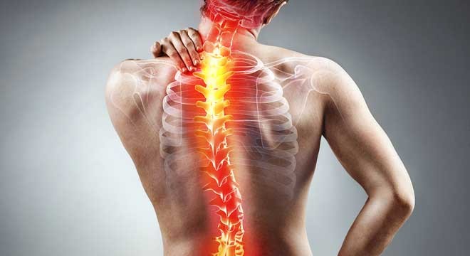 ورزش هایی برای بهبود اسکولیوز