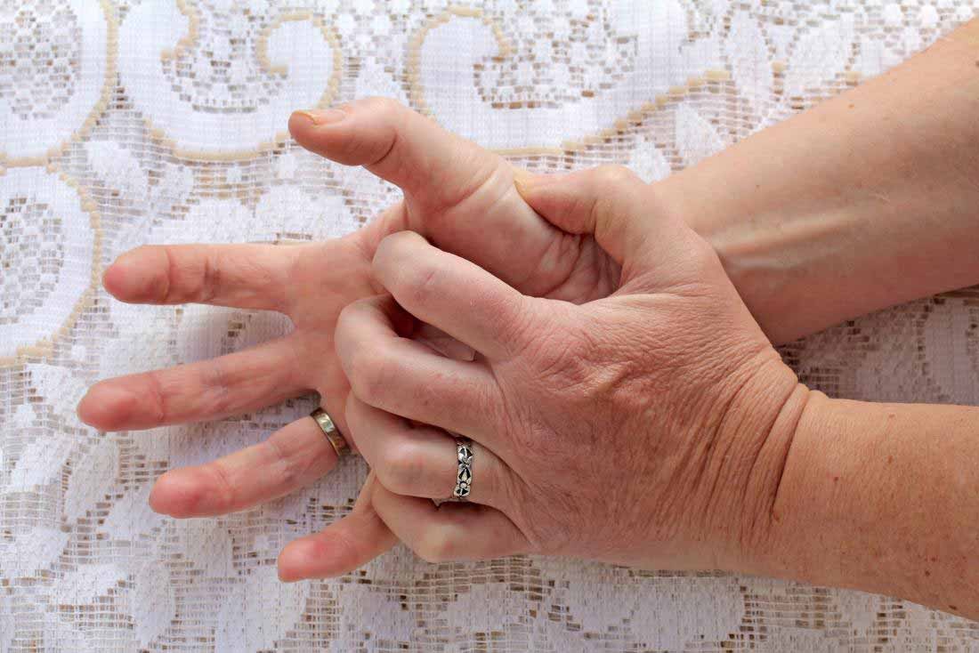نکاتی برای پیشگیری از بیماری های پوستی