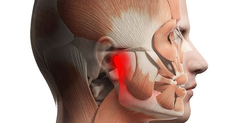 درمان های خانگی برای تسکین درد فک