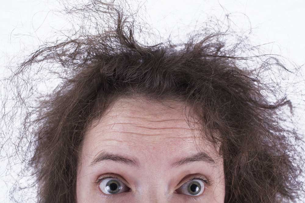 چگونه از شر موهای وز خلاص شویم؟