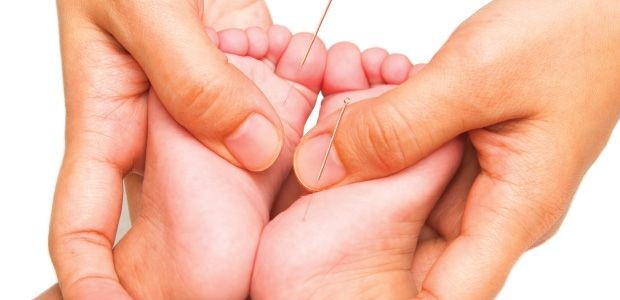 آیا طب سوزنی برای کودکان بی‌خطر است؟ آنچه والدین باید بدانند