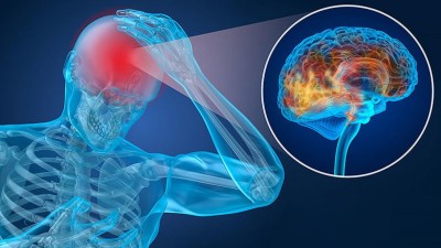 انواع رایج آسیب‌های مغزی و علائم آنها