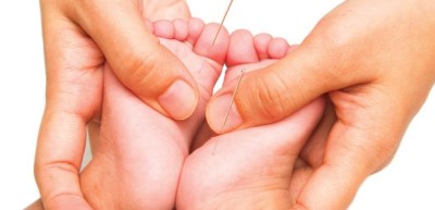 آیا طب سوزنی برای کودکان بی‌خطر است؟ آنچه والدین باید بدانند